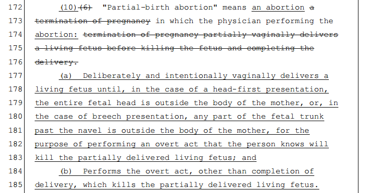 Definition: Partial Birth Abortion